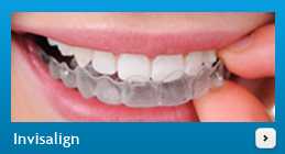 Invisalign